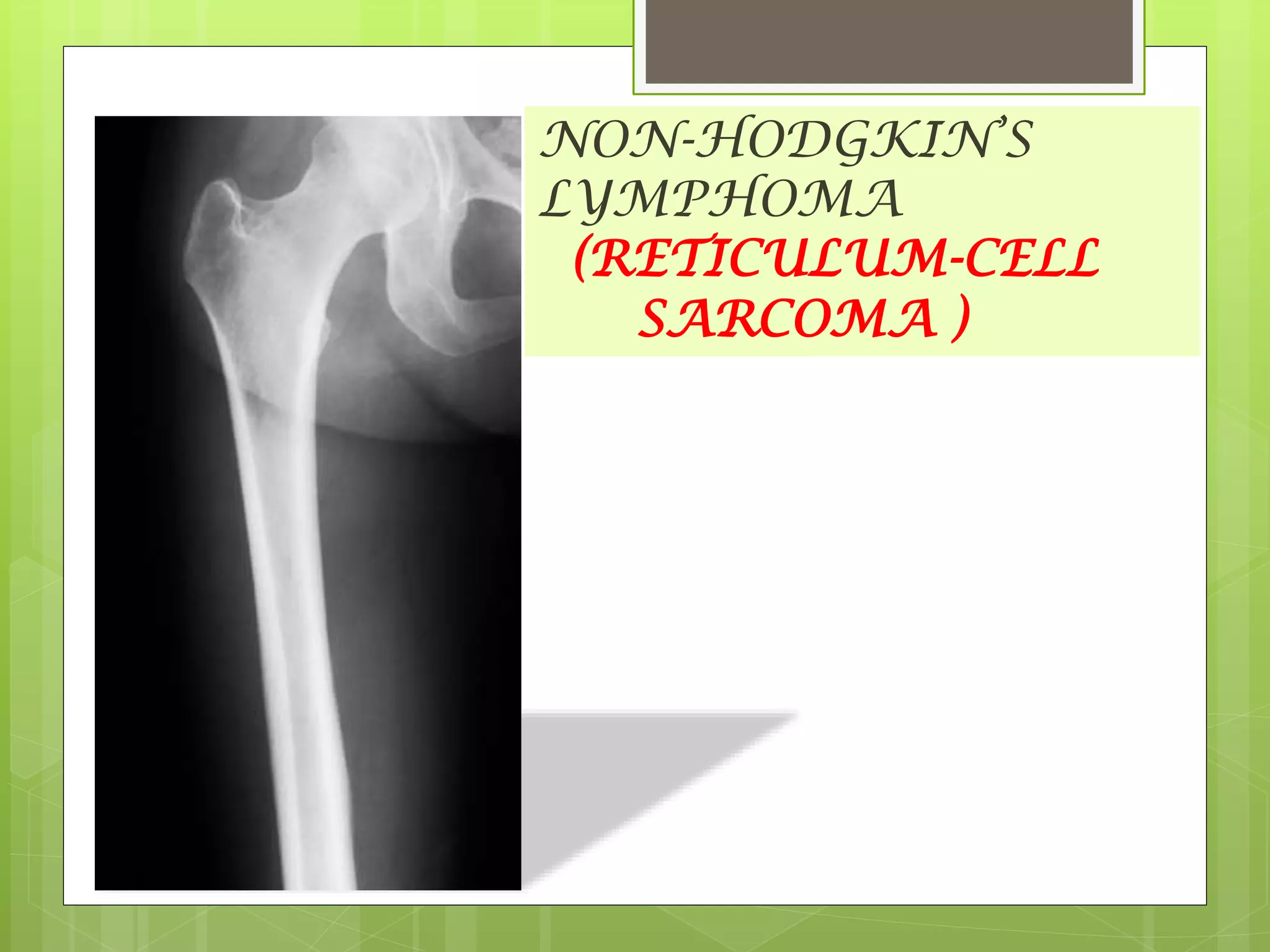 NON-HODGKIN’S
LYMPHOMA
(RETICULUM-CELL
SARCOMA )
 