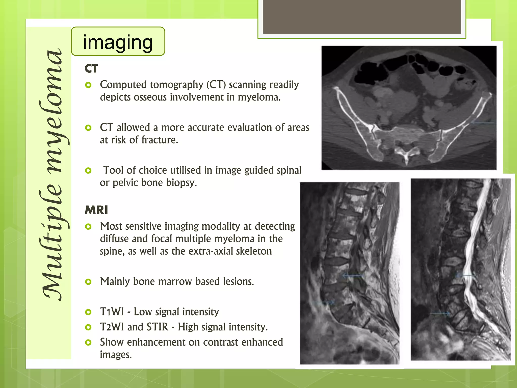 Multiplemyeloma imaging
CT
 Computed tomography (CT) scanning readily
depicts osseous involvement in myeloma.
 CT allowed a more accurate evaluation of areas
at risk of fracture.
 Tool of choice utilised in image guided spinal
or pelvic bone biopsy.
MRI
 Most sensitive imaging modality at detecting
diffuse and focal multiple myeloma in the
spine, as well as the extra-axial skeleton
 Mainly bone marrow based lesions.
 T1WI - Low signal intensity
 T2WI and STIR - High signal intensity.
 Show enhancement on contrast enhanced
images.
 