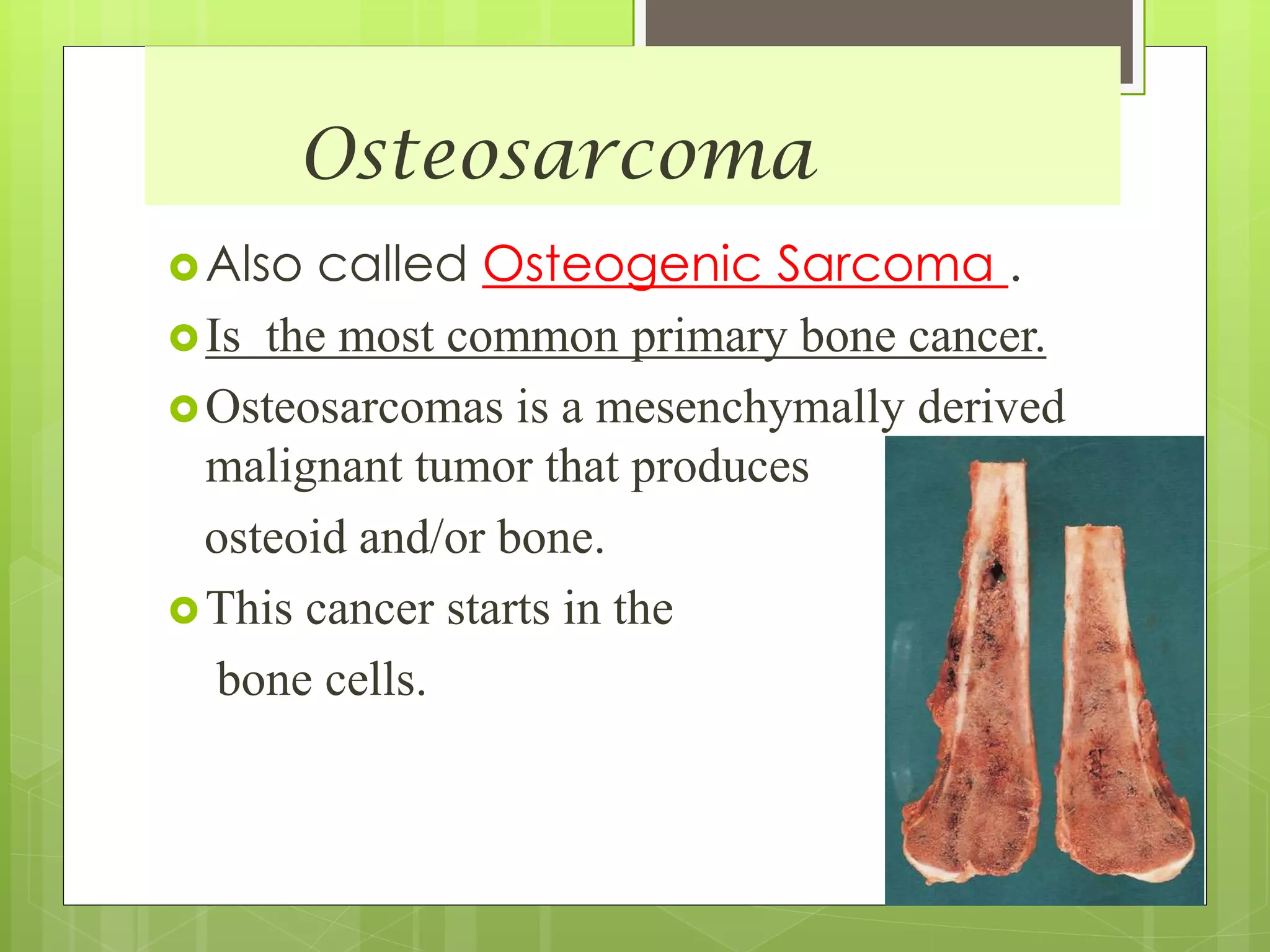 Osteosarcoma
Also called Osteogenic Sarcoma .
Is the most common primary bone cancer.
Osteosarcomas is a mesenchymally derived
malignant tumor that produces
osteoid and/or bone.
This cancer starts in the
bone cells.
 