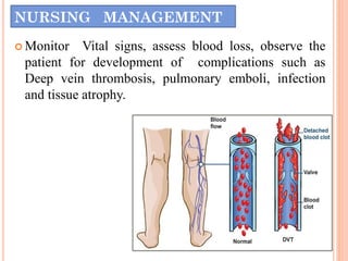 NURSING MANAGEMENT
 Monitor Vital signs, assess blood loss, observe the
patient for development of complications such as
Deep vein thrombosis, pulmonary emboli, infection
and tissue atrophy.
 