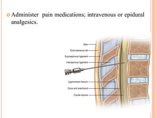 Administer pain medications; intravenous or epidural
analgesics.
 