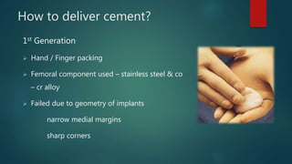 How to deliver cement?
1st Generation
 Hand / Finger packing
 Femoral component used – stainless steel & co
– cr alloy
 Failed due to geometry of implants
narrow medial margins
sharp corners
 