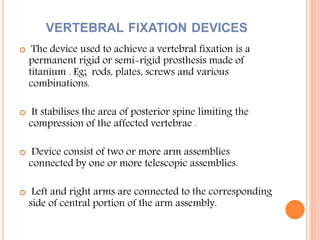 Semi Rigid Fixation Examples Bone cement and spinal fixation | PPTX