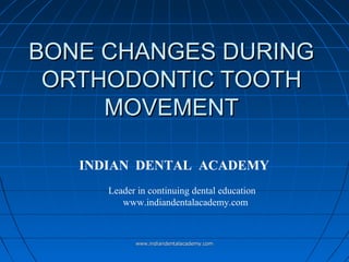 BONE CHANGES DURING
ORTHODONTIC TOOTH
MOVEMENT
INDIAN DENTAL ACADEMY
Leader in continuing dental education
www.indiandentalacademy.com

www.indiandentalacademy.com

 