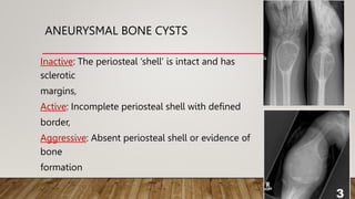 Bone Cysts in Children.pptx