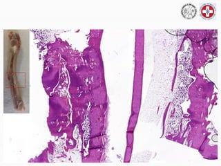 Healing of extensive bone defects (in vivo study in a rabbit model). | PPTX
