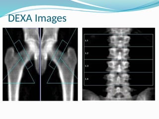 bone densitometry in orthopedic clinical practice.pptx