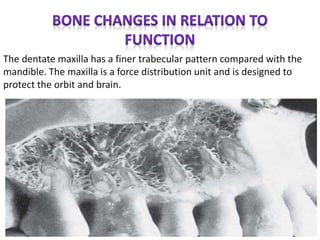 The dentate maxilla has a finer trabecular pattern compared with the
mandible. The maxilla is a force distribution unit and is designed to
protect the orbit and brain.
 