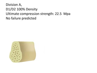 Division A,
D1/D2 100% Density
Ultimate compression strength: 22.5 Mpa
No failure predicted
 