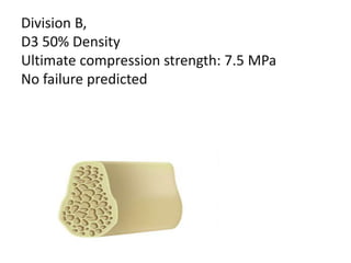 Division B,
D3 50% Density
Ultimate compression strength: 7.5 MPa
No failure predicted
 