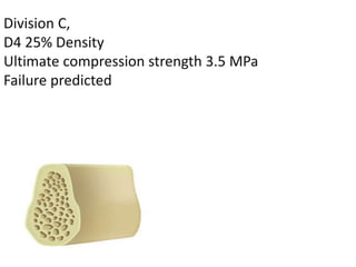 Division C,
D4 25% Density
Ultimate compression strength 3.5 MPa
Failure predicted
 