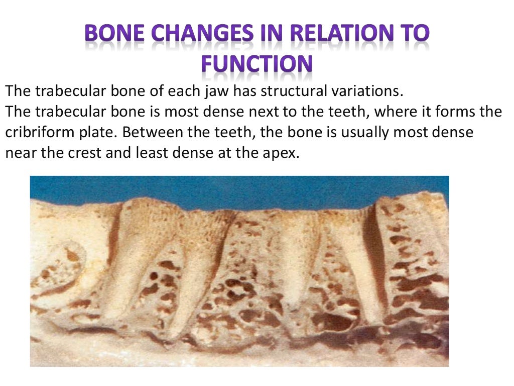Bone density for dental implant.