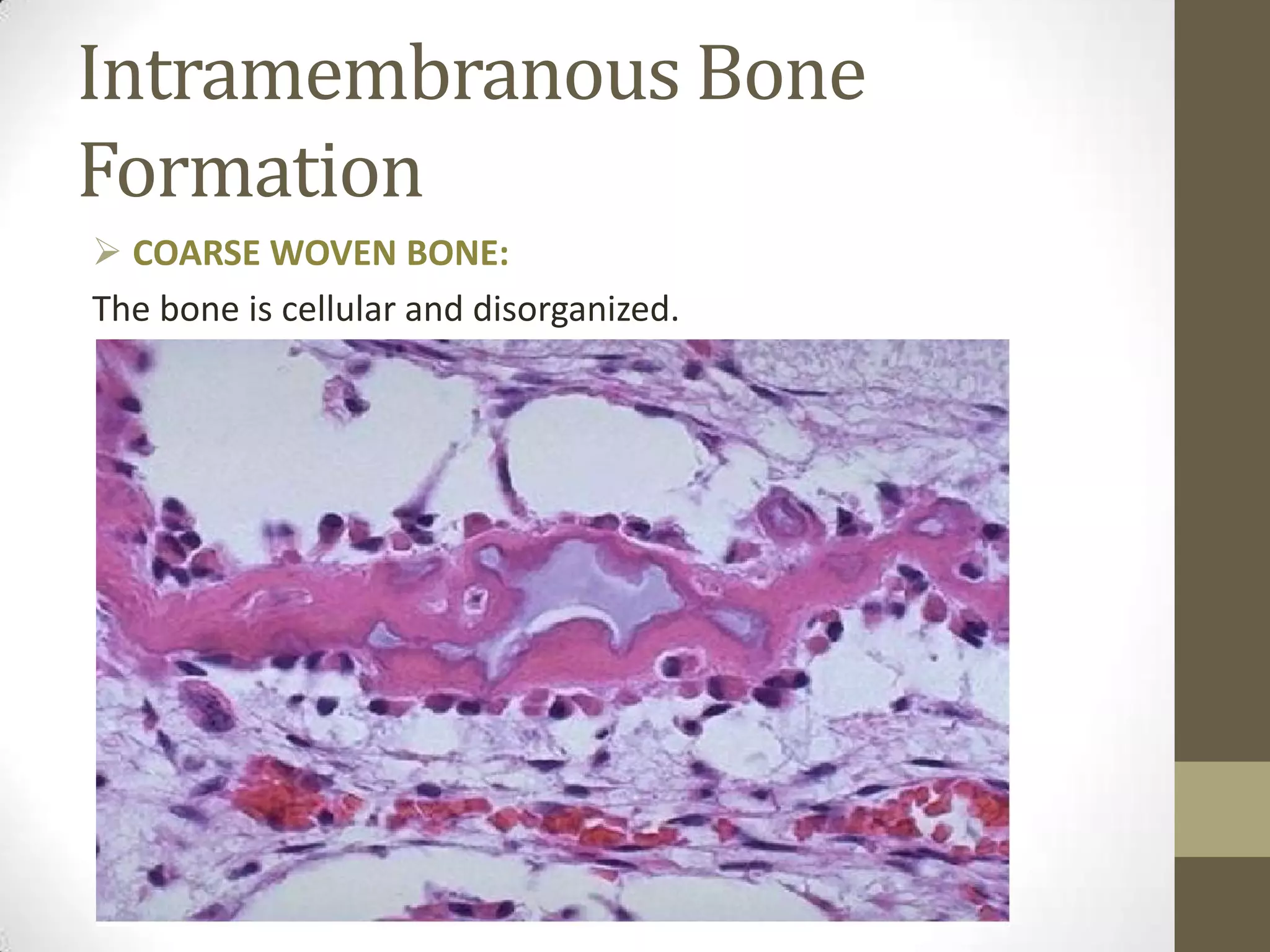 Intramembranous Bone
Formation
 COARSE WOVEN BONE:
The bone is cellular and disorganized.

 