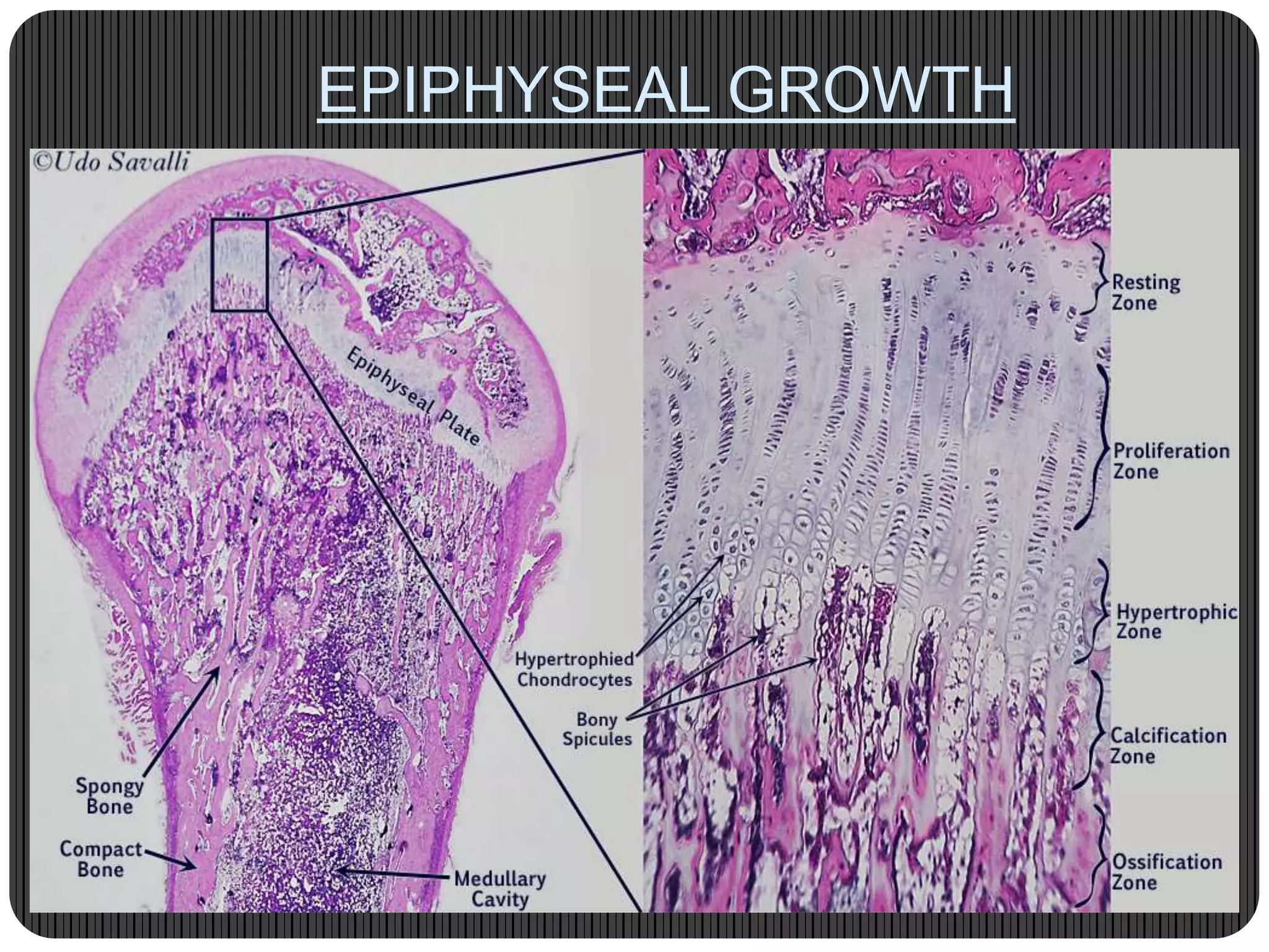 Bone development & growth | PPTX
