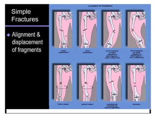Bone disease imaging for students 2012 part1 | PPT