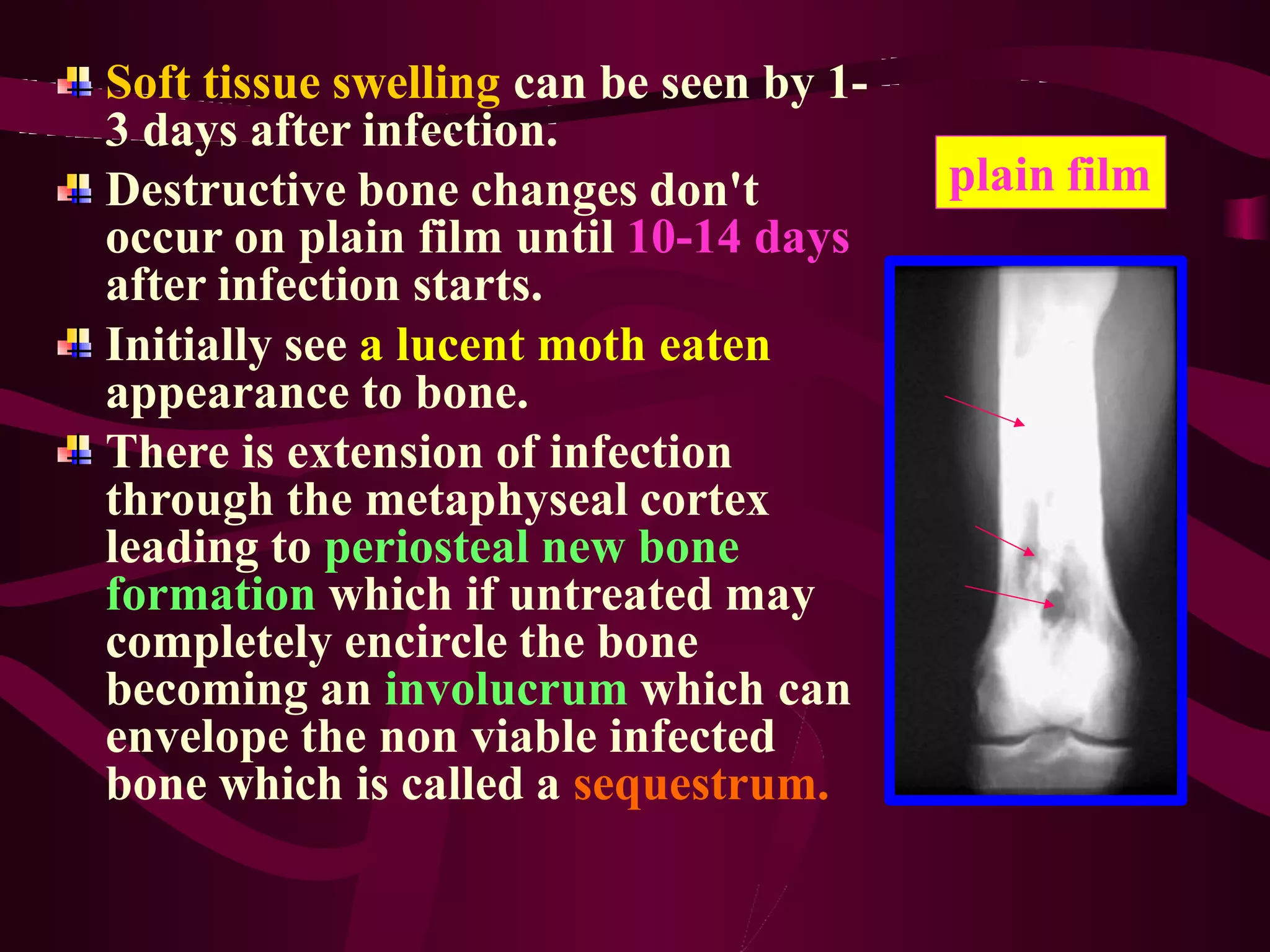 bone diseases.pptx