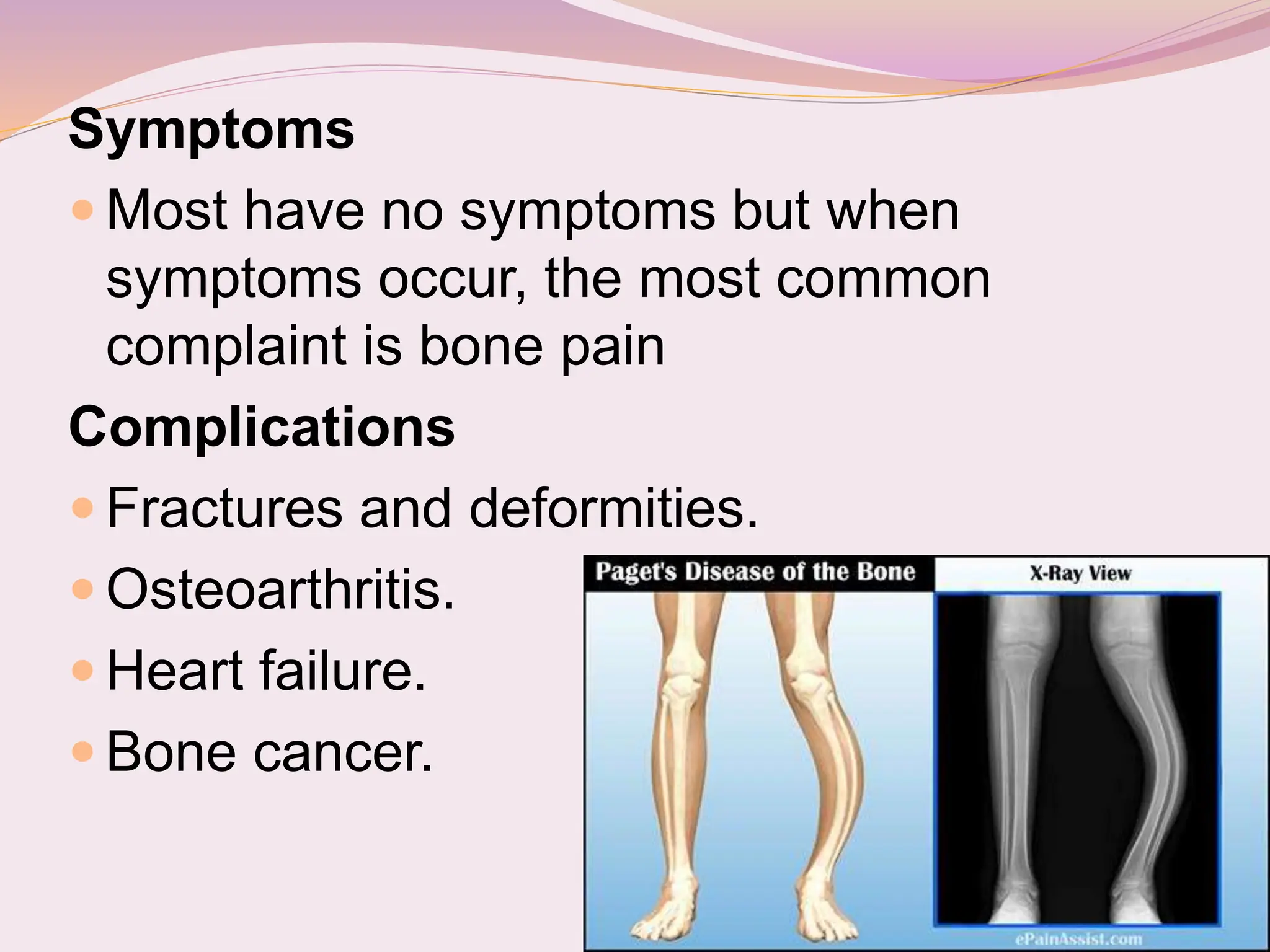 bone DISEASES.ppt