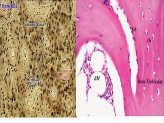 Comprehensive Overview of Bone Tumors: Classification, Grading, and ...
