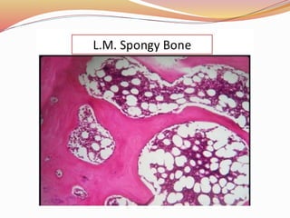 Comprehensive Overview of Bone Tumors: Classification, Grading, and ...