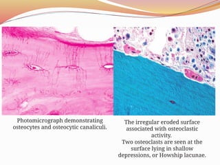 Comprehensive Overview of Bone Tumors: Classification, Grading, and ...