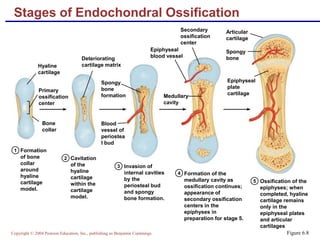 Copyright © 2004 Pearson Education, Inc., publishing as Benjamin Cummings
Formation
of bone
collar
around
hyaline
cartilage
model.
1
2
3
4
Cavitation
of the
hyaline
cartilage
within the
cartilage
model.
Invasion of
internal cavities
by the
periosteal bud
and spongy
bone formation.
5 Ossification of the
epiphyses; when
completed, hyaline
cartilage remains
only in the
epiphyseal plates
and articular
cartilages
Formation of the
medullary cavity as
ossification continues;
appearance of
secondary ossification
centers in the
epiphyses in
preparation for stage 5.
Hyaline
cartilage
Primary
ossification
center
Bone
collar
Deteriorating
cartilage matrix
Spongy
bone
formation
Blood
vessel of
periostea
l bud
Secondary
ossification
center
Epiphyseal
blood vessel
Medullary
cavity
Epiphyseal
plate
cartilage
Spongy
bone
Articular
cartilage
Stages of Endochondral Ossification
Figure 6.8
 