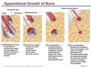 Copyright © 2004 Pearson Education, Inc., publishing as Benjamin Cummings
Osteoblasts beneath
the periosteum
secrete bone matrix,
forming ridges that
follow the course of
periosteal blood
vessels.
1 2 3 4As the bony ridges
enlarge and meet,
the groove
containing the
blood vessel
becomes a tunnel.
The periosteum
lining the tunnel is
transformed into an
endosteum and the
osteoblasts just
deep to the tunnel
endosteum secrete
bone matrix,
narrowing the canal.
As the osteoblasts
beneath the endosteum
form new lamellae, a new
osteon is created.
Meanwhile new
circumferential lamellae
are elaborated beneath
the periosteum and the
process is repeated,
continuing to enlarge
bone diameter.
Artery Periosteum Penetrating canal
Central canal of osteon
Periosteal ridge
Appositional Growth of Bone
Figure 6.11
 