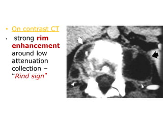 bone fracture.pptx