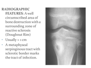 bone fracture.pptx