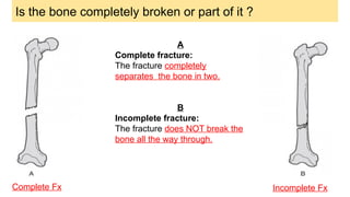Bone Fractures in adults and children. types of bone fracture and ...
