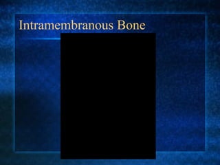 Intramembranous Bone 