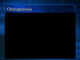 Osteoperosis 