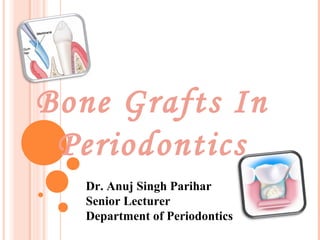 Bone Grafts In
Periodontics
Dr. Anuj Singh Parihar
Senior Lecturer
Department of Periodontics
 