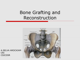 Bone Grafting and
Reconstruction
A.SELVA AROCKIAM
CRI
CSICDSR
 