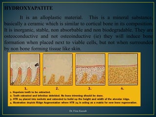 Bone graft | PDF