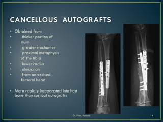 • Obtained from
• thicker portion of
ilium
• greater trochanter
• proximal metaphysis
of the tibia
• lower radius
• olecranon
• from an excised
femoral head
• More rapidly incoporated into host
bone than cortical autografts
Dr. Firas Kassab 14
 