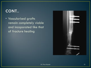 • Vascularised grafts
remain completely viable
and incoporated like that
of fracture healing
Dr. Firas Kassab 21
 