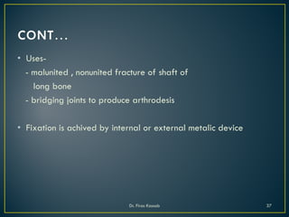 • Uses-
- malunited , nonunited fracture of shaft of
long bone
- bridging joints to produce arthrodesis
• Fixation is achived by internal or external metalic device
Dr. Firas Kassab 37
 