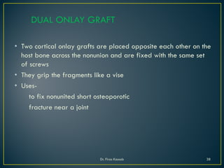 DUAL ONLAY GRAFT
• Two cortical onlay grafts are placed opposite each other on the
host bone across the nonunion and are fixed with the same set
of screws
• They grip the fragments like a vise
• Uses-
to fix nonunited short osteoporotic
fracture near a joint
Dr. Firas Kassab 38
 