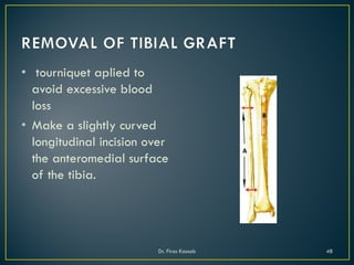 • tourniquet aplied to
avoid excessive blood
loss
• Make a slightly curved
longitudinal incision over
the anteromedial surface
of the tibia.
Dr. Firas Kassab 48
 