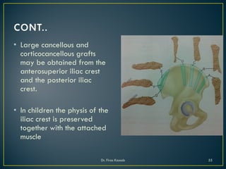• Large cancellous and
corticocancellous grafts
may be obtained from the
anterosuperior iliac crest
and the posterior iliac
crest.
• In children the physis of the
iliac crest is preserved
together with the attached
muscle
Dr. Firas Kassab 55
 