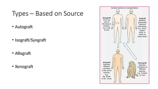 Bone graft Dr bikrant.pptx bone graft substitute | PPTX