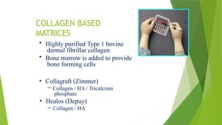 bone grafts used in orthopedic surgery.pptx