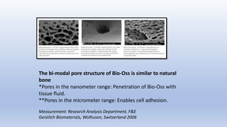 Bone grafts and growth factors implantology | PPTX