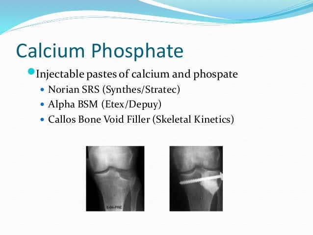Bone Grafts And Substitutes