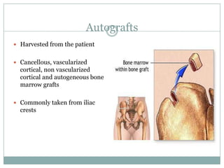 Autografts
 Harvested from the patient
 Cancellous, vascularized
cortical, non vascularized
cortical and autogeneous bone
marrow grafts
 Commonly taken from iliac
crests
 