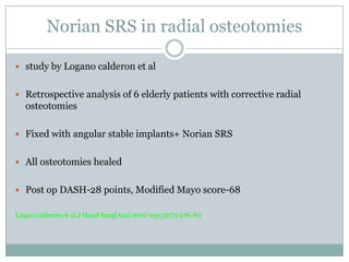 Norian SRS in radial osteotomies
 study by Logano calderon et al
 Retrospective analysis of 6 elderly patients with corrective radial
osteotomies
 Fixed with angular stable implants+ Norian SRS
 All osteotomies healed
 Post op DASH-28 points, Modified Mayo score-68
Logan calderon et al J Hand Surg[Am] 2007 sep;32(7):976-83
 