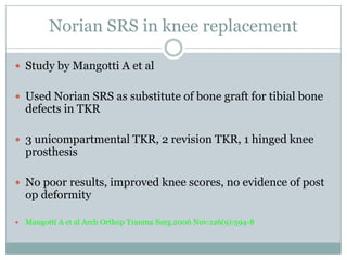 Norian SRS in knee replacement
 Study by Mangotti A et al
 Used Norian SRS as substitute of bone graft for tibial bone
defects in TKR
 3 unicompartmental TKR, 2 revision TKR, 1 hinged knee
prosthesis
 No poor results, improved knee scores, no evidence of post
op deformity
 Mangotti A et al Arch Orthop Trauma Surg.2006 Nov:126(9):594-8
 