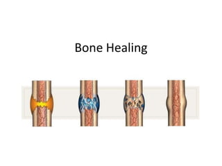 Bone Healing
 