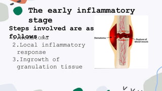 The early inflammatory
stage
Steps involved are as
follows :-
1.Hematoma
2.Local inflammatory
response
3.Ingrowth of
granulation tissue
 