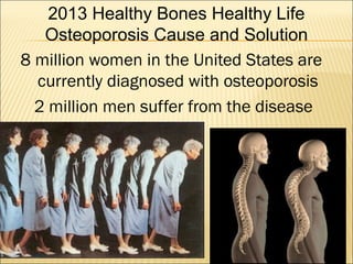 8 million women in the United States are
currently diagnosed with osteoporosis
2 million men suffer from the disease
2013 Healthy Bones Healthy Life
Osteoporosis Cause and Solution
 